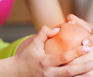 ACL Injuries