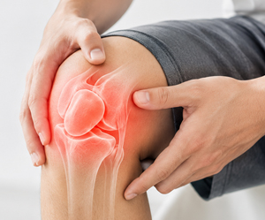 Patellofemoral Pain Syndrome (Runner's Knee)